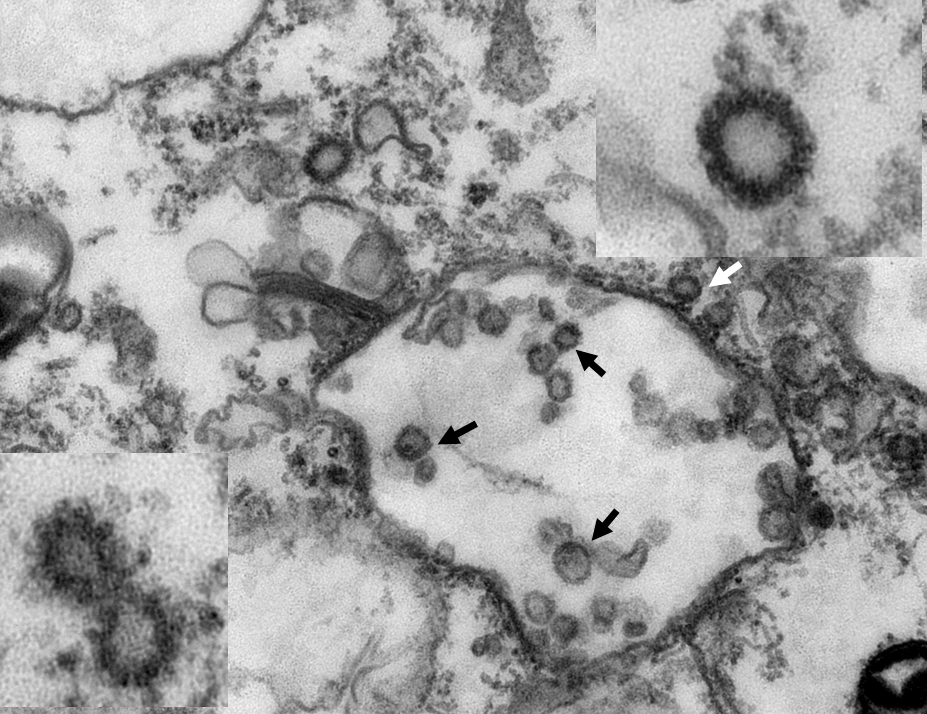 从穿山甲组织中提取的新型冠状病毒电镜照片。华农供图