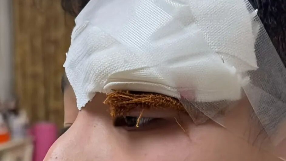 演员关凌向儿子道歉：我一失手他缝了四针