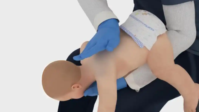 一起学！海姆立克急救法更新了