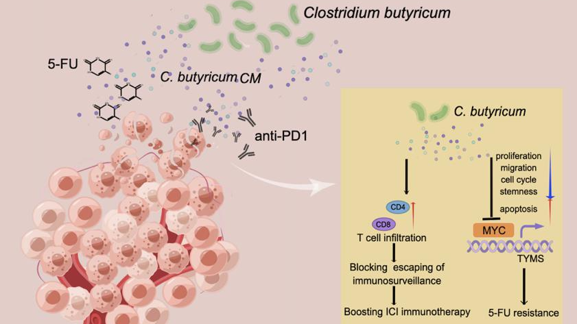 GD's medical team: a probiotic can be used for adjuvant treatment of colorectal cancer