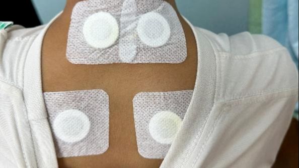 孩子咳不停，吃药像打仗？试试这7种不吃药的中医外治法→