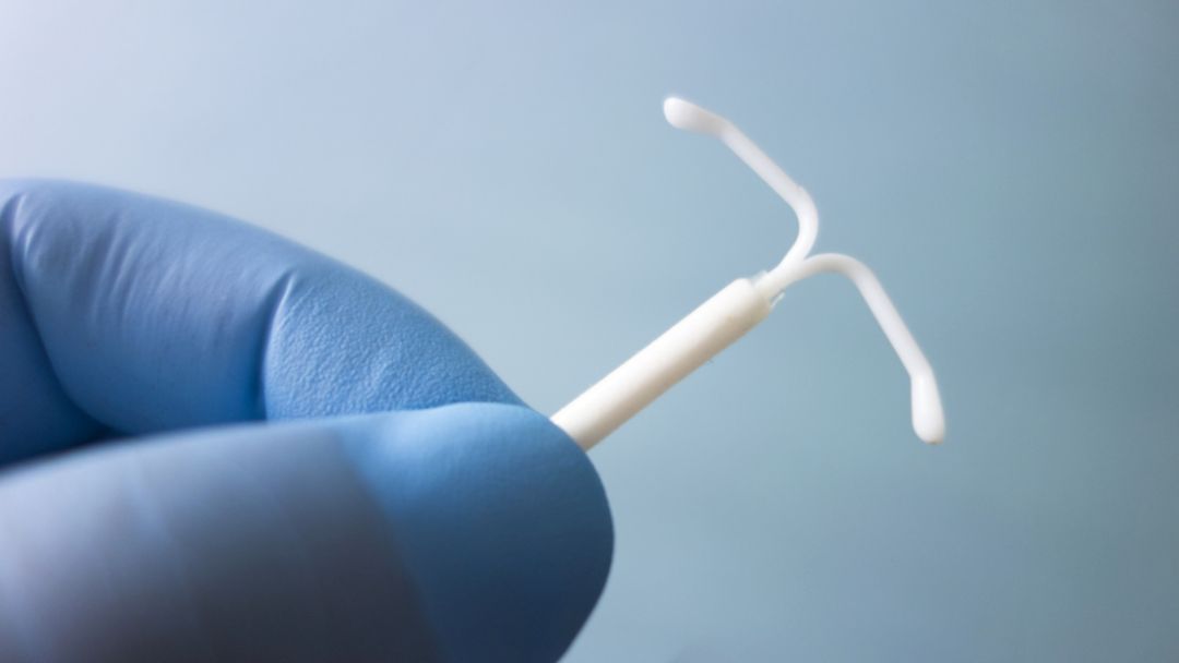 既能高效避孕又能调理月经？一举多得的“宫内小卫士”知多D！