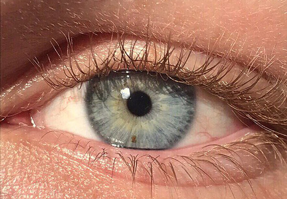 New laser surgery lets you change eye color from brown to blue in only 20 seconds