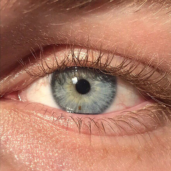 New laser surgery lets you change eye color from brown to blue in only 20 seconds
