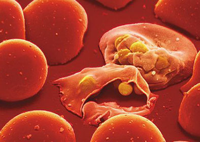 WHO sounds wake-up call to counter stall in anti-malaria fight