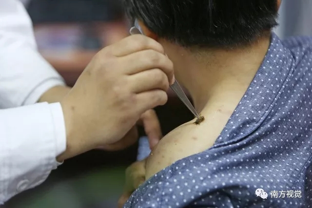 Bee stings can treat illness?