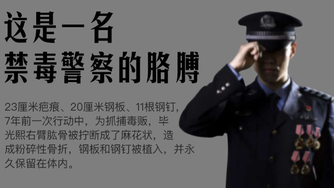 看着都疼！缉毒警右臂有11根永久性钢钉