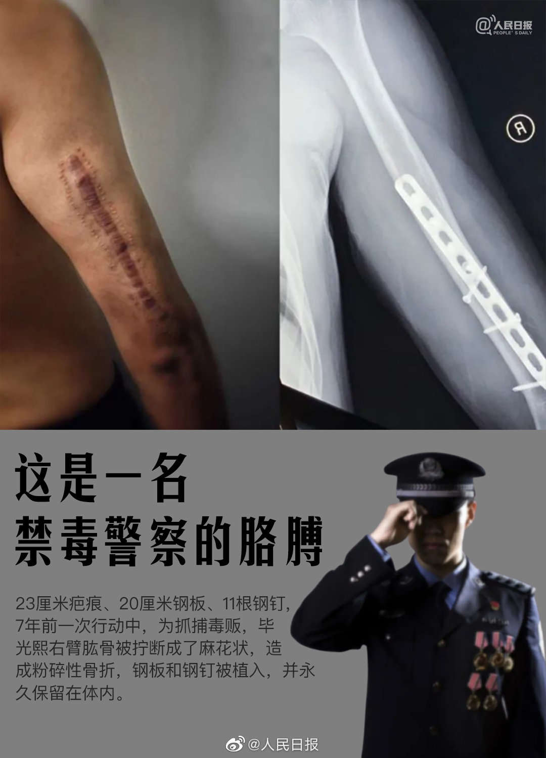 0033ImPzly1h3lbg0l4h7j60u015ngpk02.jpg?x-oss-process=style/w10