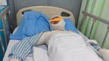 中考前突击加训酿祸!东莞水霖实验学校6名学生被酒精烧伤 中考前突击加训酿祸!东莞水霖实验学校6名学生被酒精烧伤