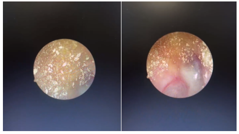 Got itches in your ear? It might result from your cat