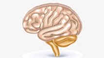 如何预防脑卒中?专家介绍:识别早,效果好! 如何预防脑卒中?专家介绍:识别早,效果好!