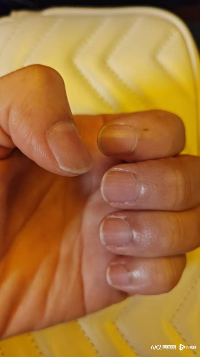 为了救人，李梦旖咬掉了穿戴甲。