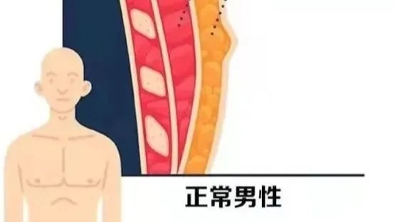 男性乳房也胀痛？当男性遇到乳房问题该怎么办？