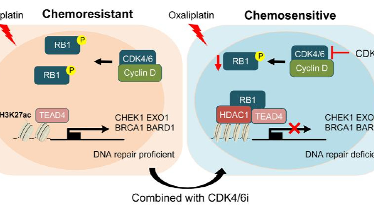 GD team makes breakthrough on chemo-resistant rectal cancer
