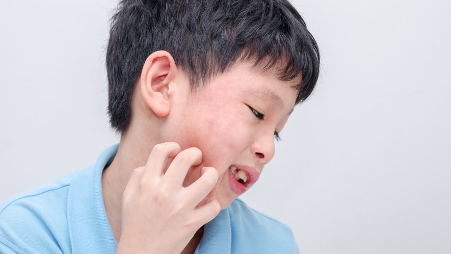 别一过敏就乱吃药！儿童抗组胺药这样用才不伤身