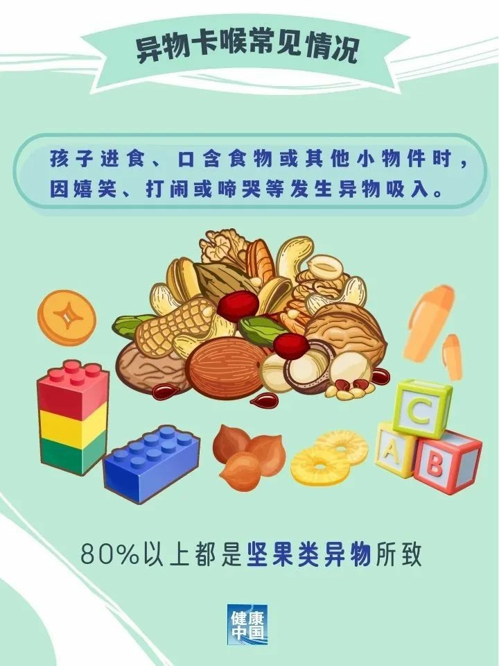儿童异物卡喉怎么办？家长必学，关键时刻能救命！