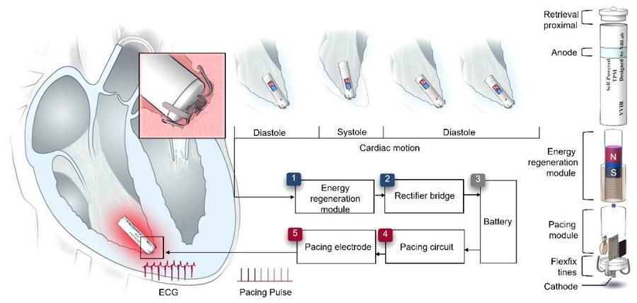 图为共生型自供电无导线心脏起搏器示意图。新华社发