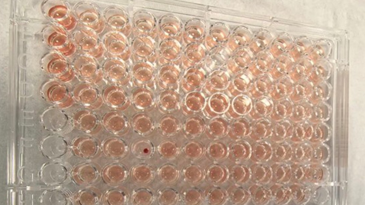 'Diamond blood' type found in S.China's Shunde, over 100 times rarer than 'panda blood'